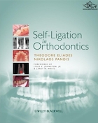 Self-Ligation in Orthodontics 1st Edición | خود لیژینگ در ارتودنسی